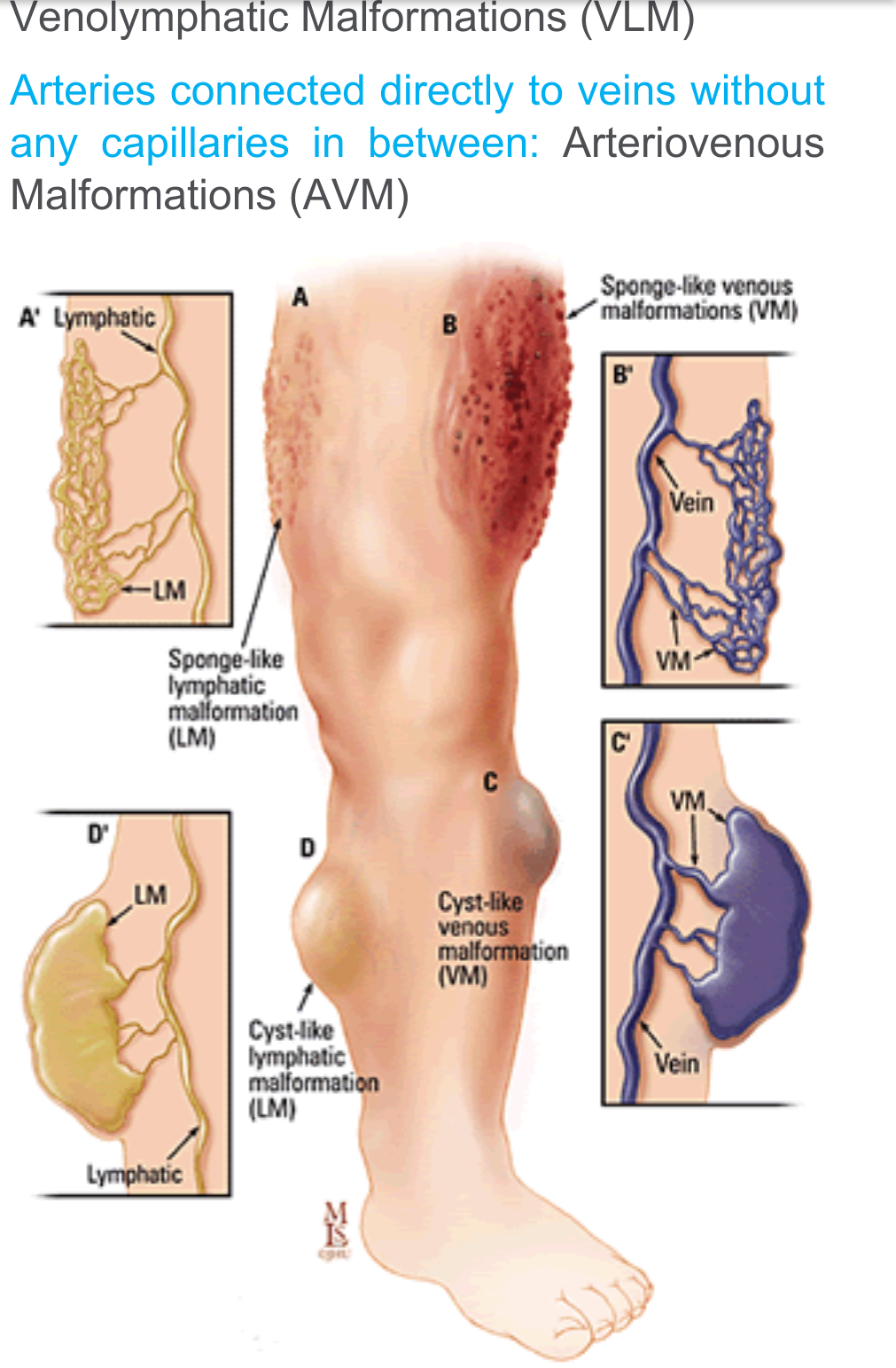 कार्यात्मक या कॉस्मेटिक समस्याएं पैदा कर सकती है संवहनी विकृति
